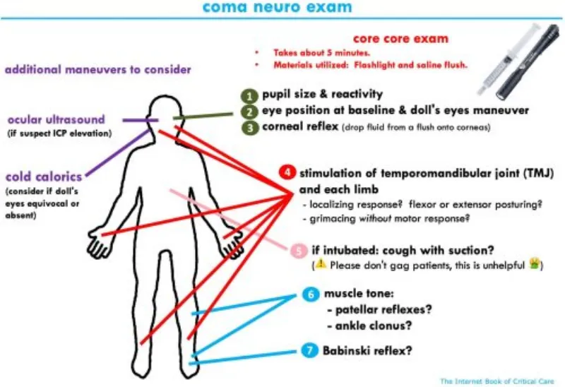 Hình ảnh minh họa phản xạ mắt búp bê